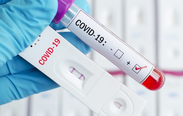 Новите случаи на заразяване с коронавирус за изтеклото денонощие у